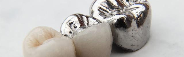 What Is A Dental Crown?