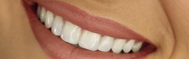 How do I know if my tooth needs replacing? How far gone is too far gone?