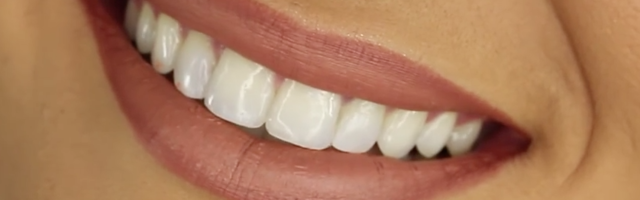 Nanotechnology for Better Dental Implants