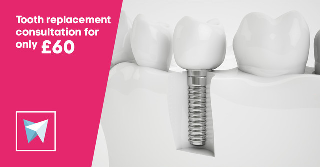 Tooth replacement consultation for only £60