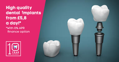 High quality dental implants from £5,8 a day!