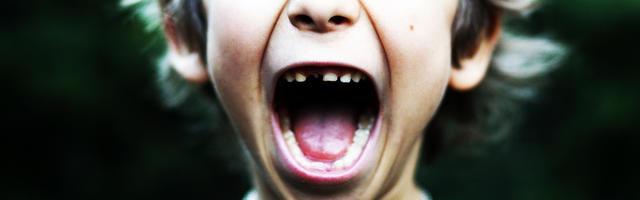Single Tooth Missing